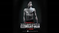 The Real and Imagined History of The Elephant Man